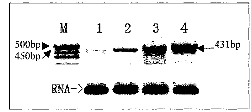 Tea geometrid reverse transcription transposon gene rtp and application thereof