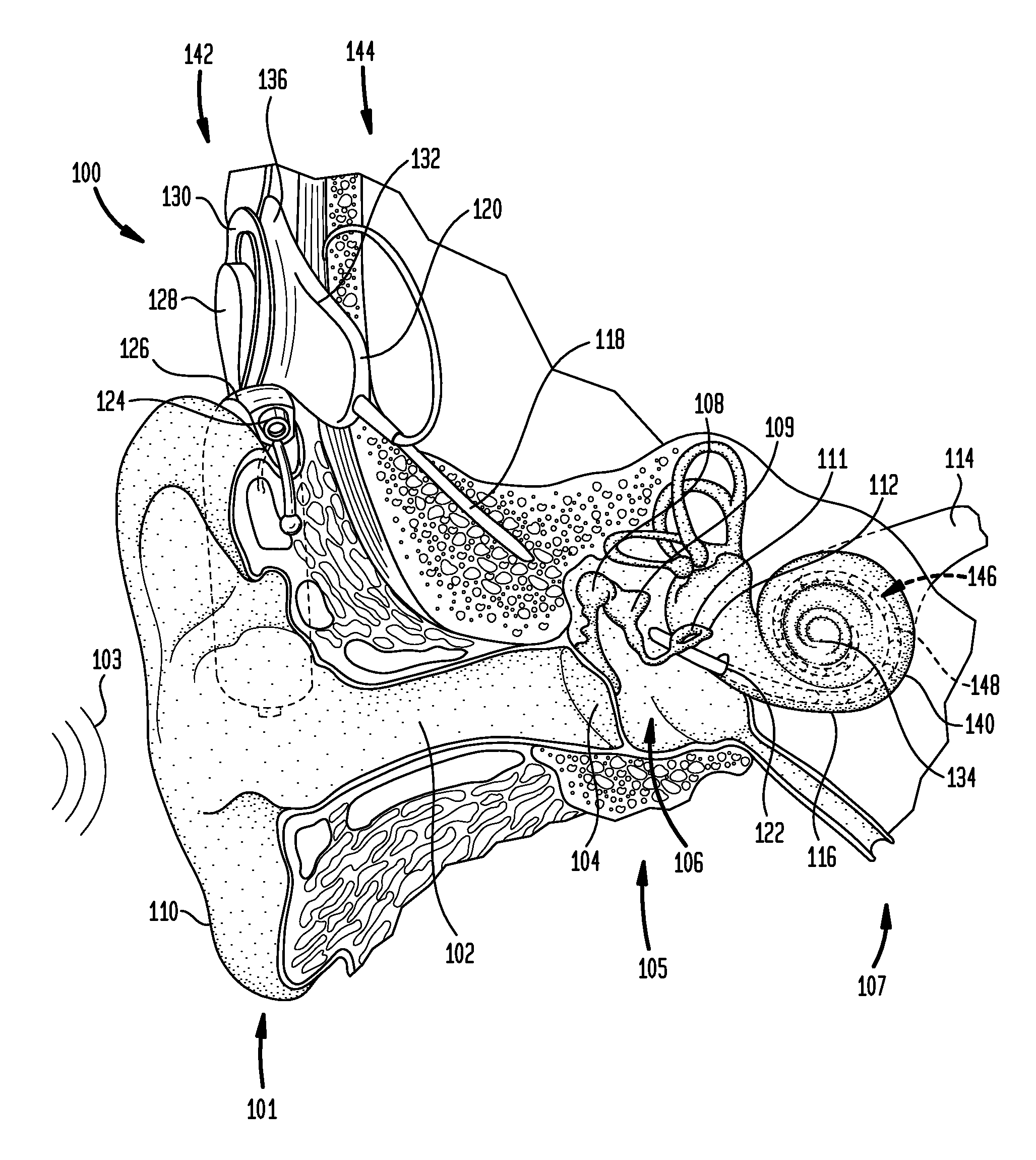 Manufacturing an electrode carrier for an implantable medical device