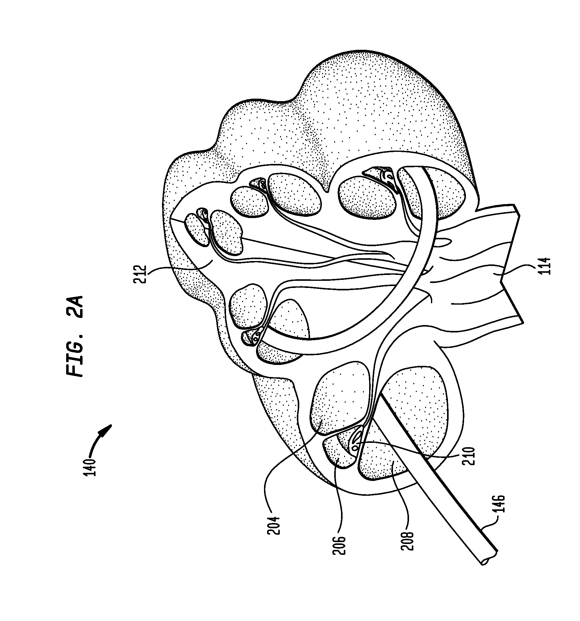 Manufacturing an electrode carrier for an implantable medical device
