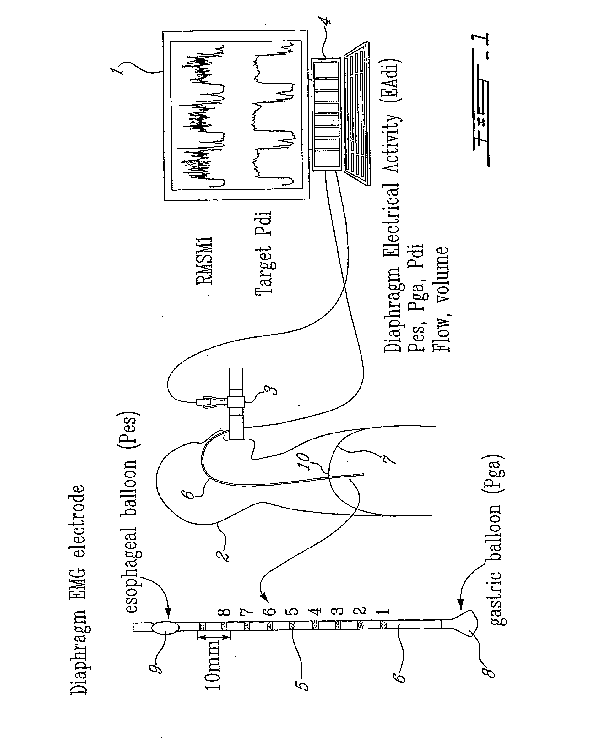 Method and Device Using Myoelectrical Activity for Optimizing a Patient's Ventilatory Assist