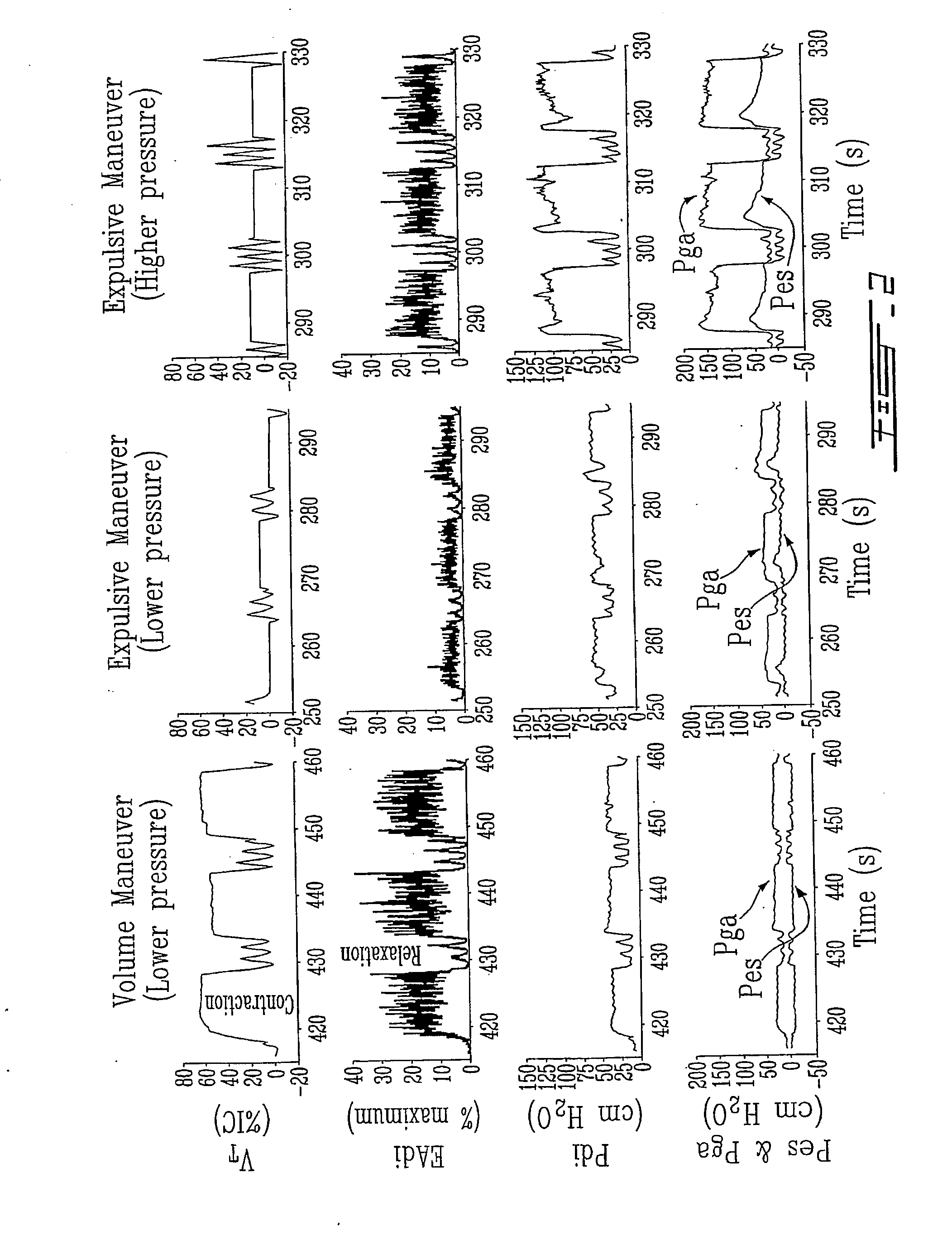 Method and Device Using Myoelectrical Activity for Optimizing a Patient's Ventilatory Assist