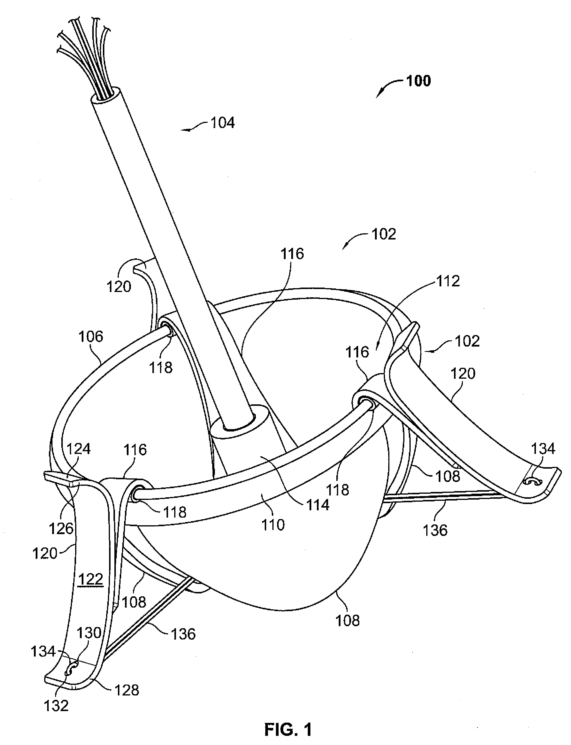 Valve Prosthesis Systems and Methods