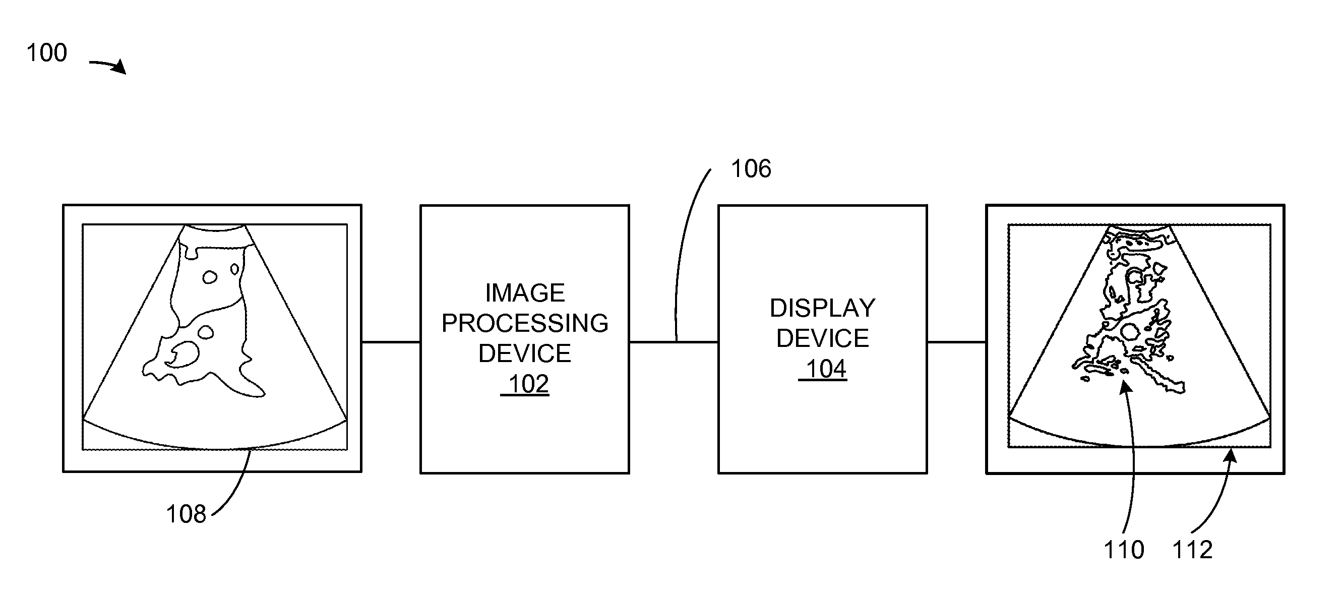 Image processing system with automatic segmentation and method of operation thereof