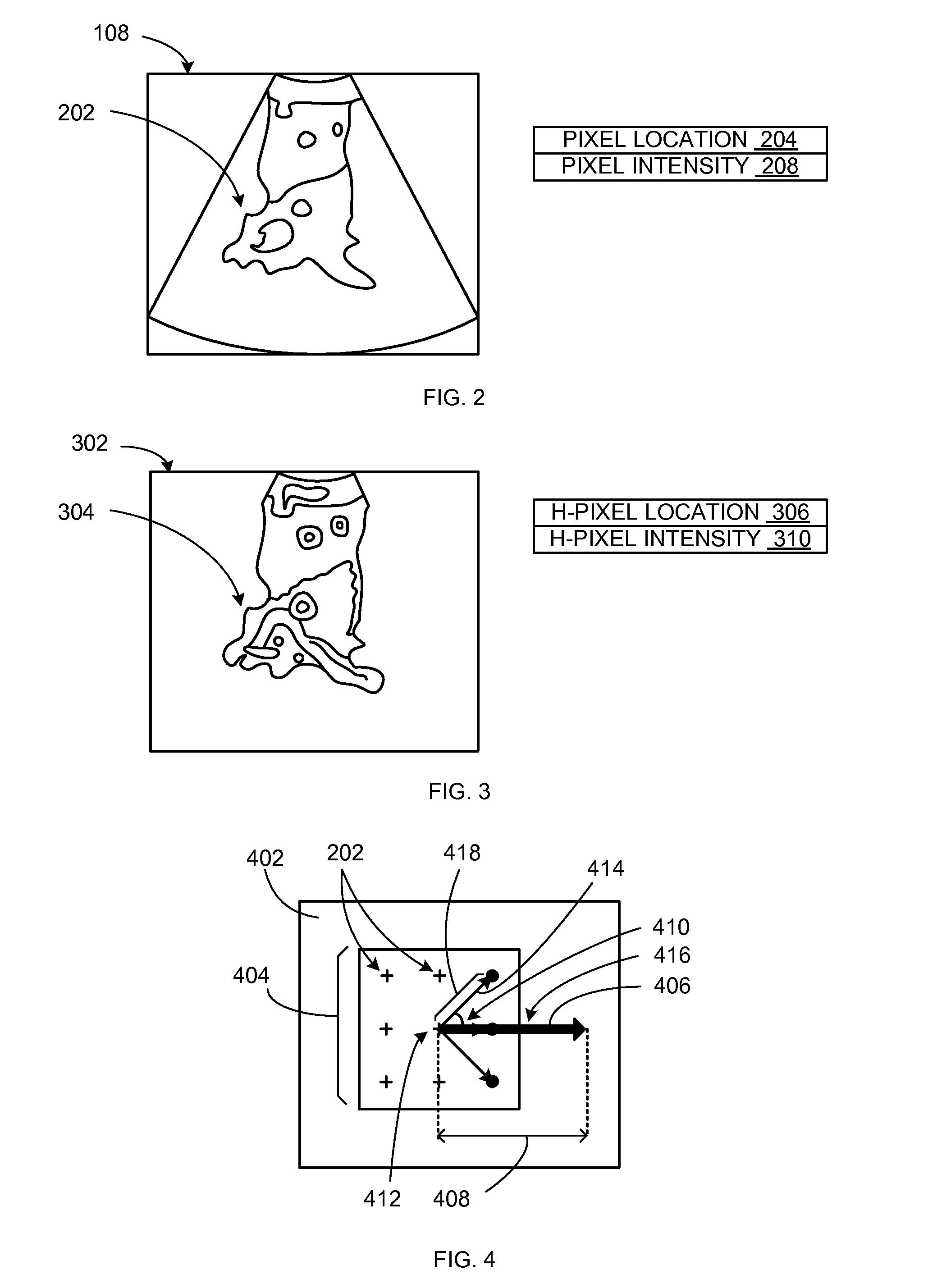 Image processing system with automatic segmentation and method of operation thereof