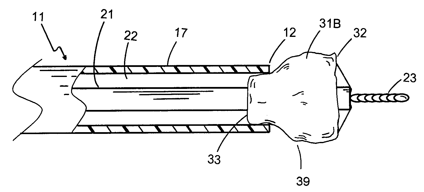 Delivery system for a stentless valve bioprosthesis