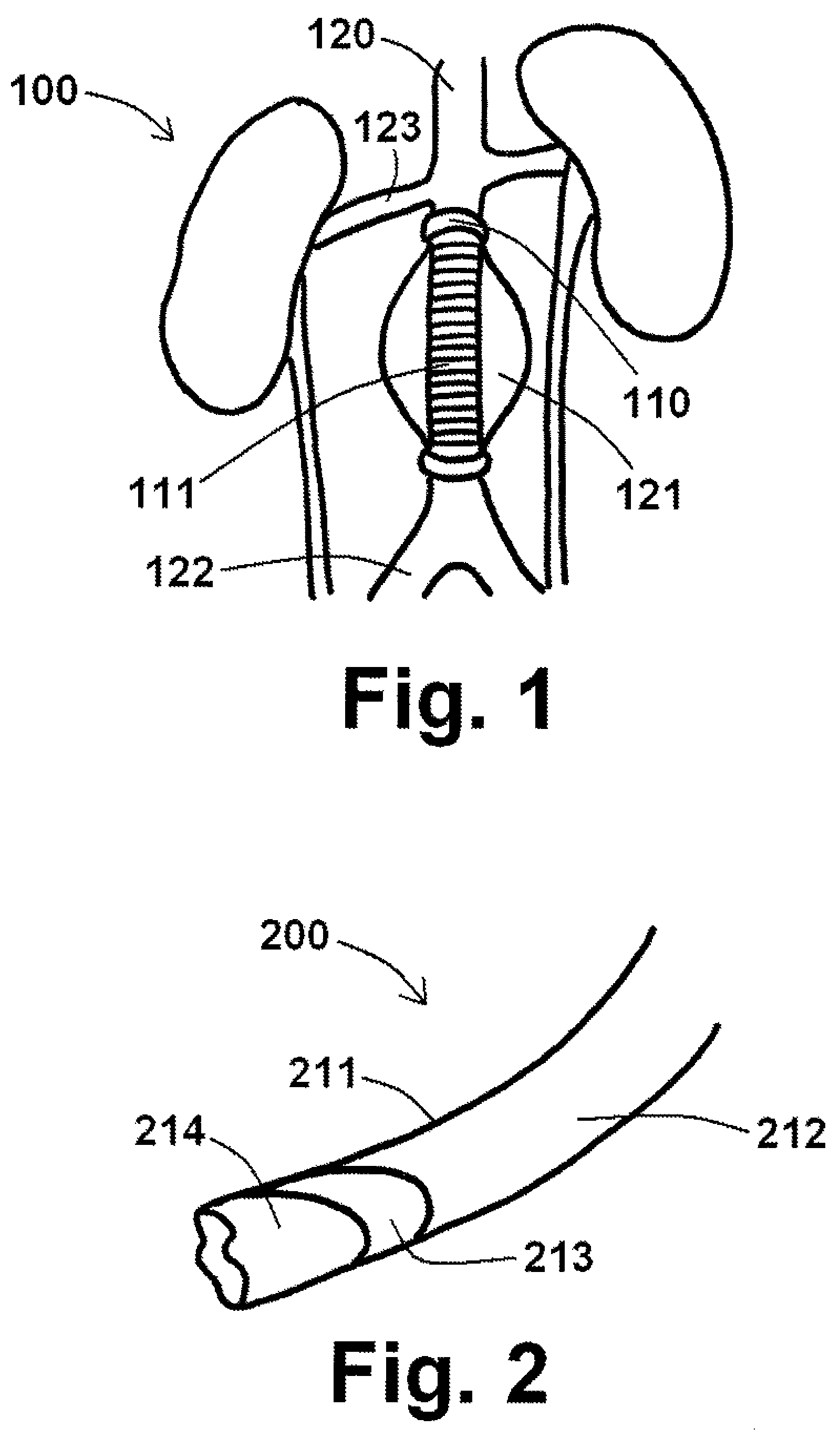 Endograft devices and methods for using the same