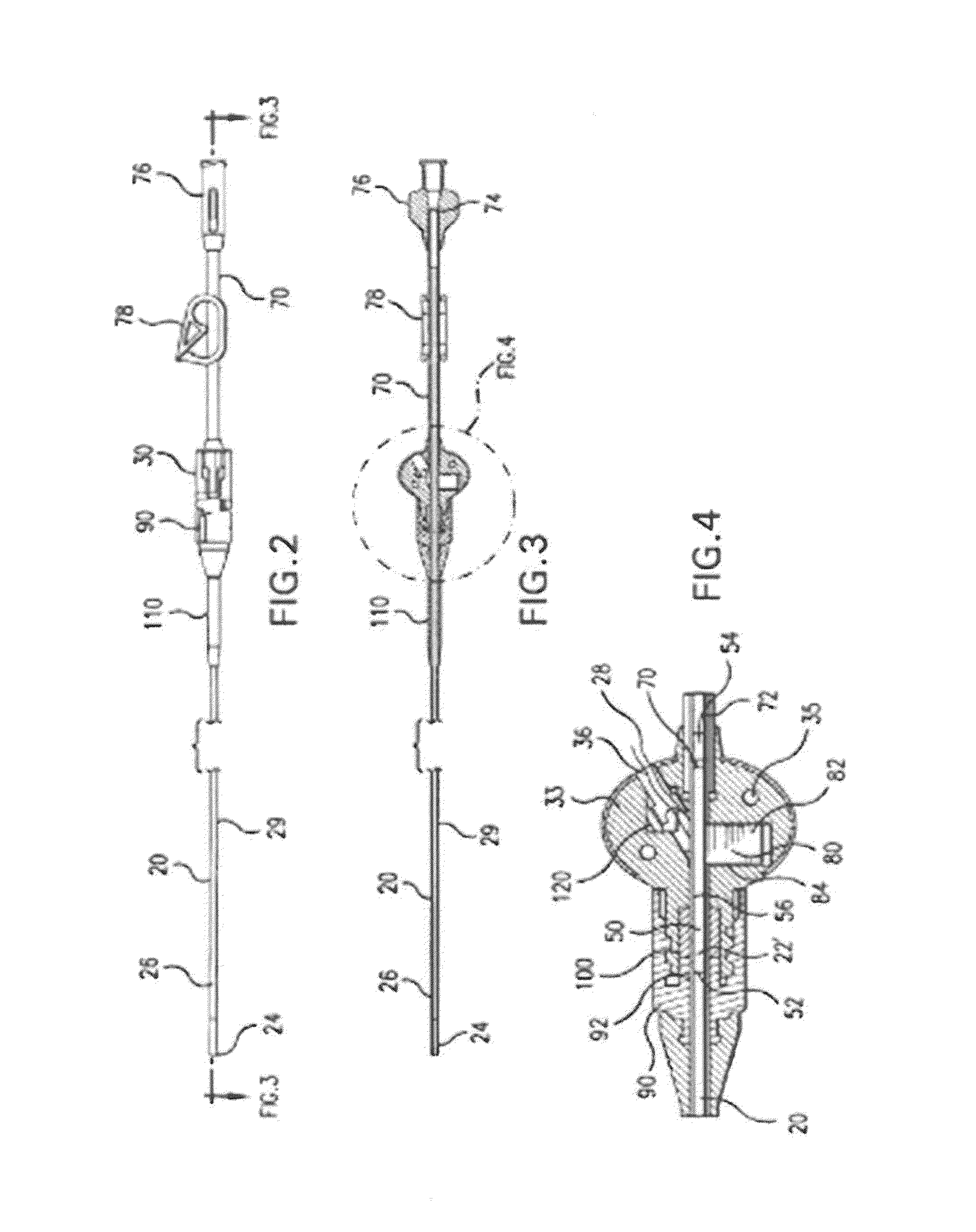 Implantable Catheter and Method of Using Same