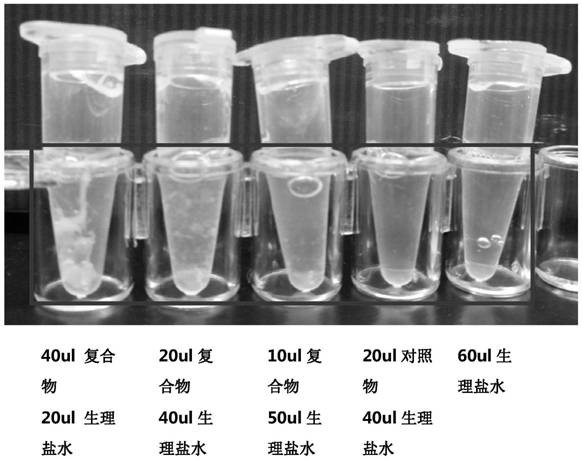 A kind of human tissue factor coagulation complex and its preparation method