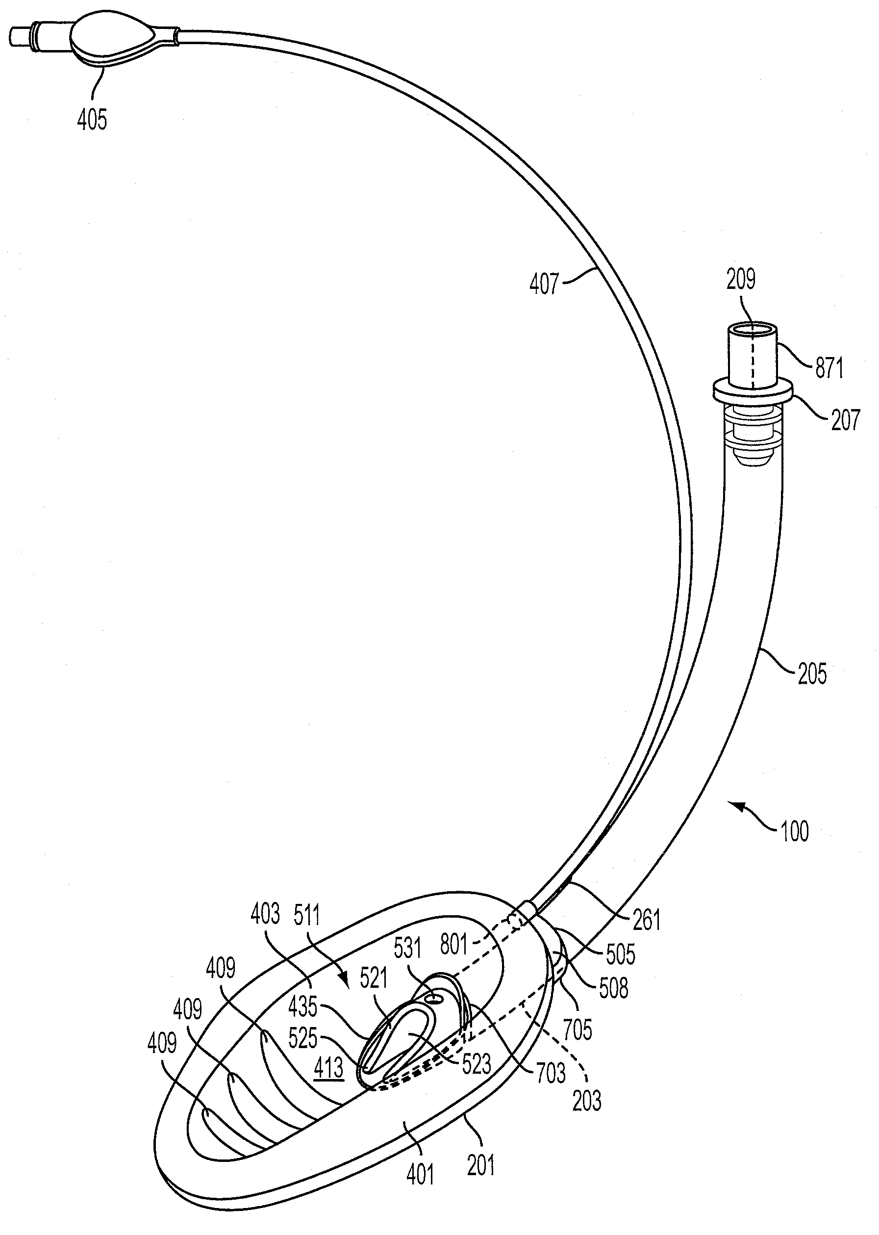 Laryngeal Mask