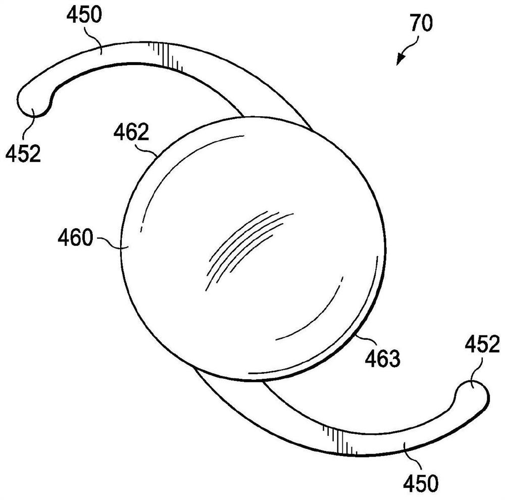 Intraocular lens injector