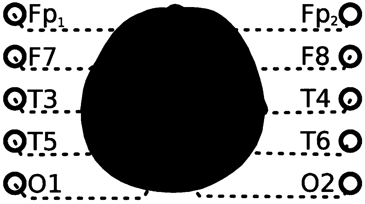 An intelligent nursing system based on brain-computer interface