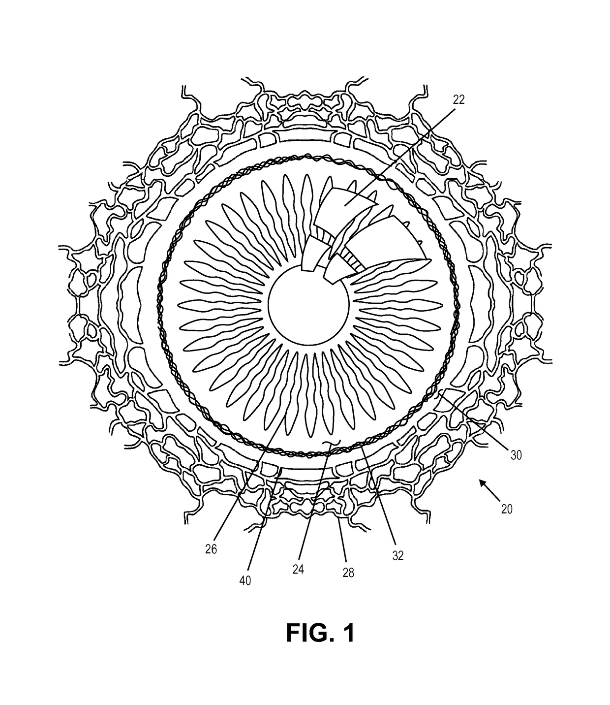 Single operator device for delivering an ocular implant