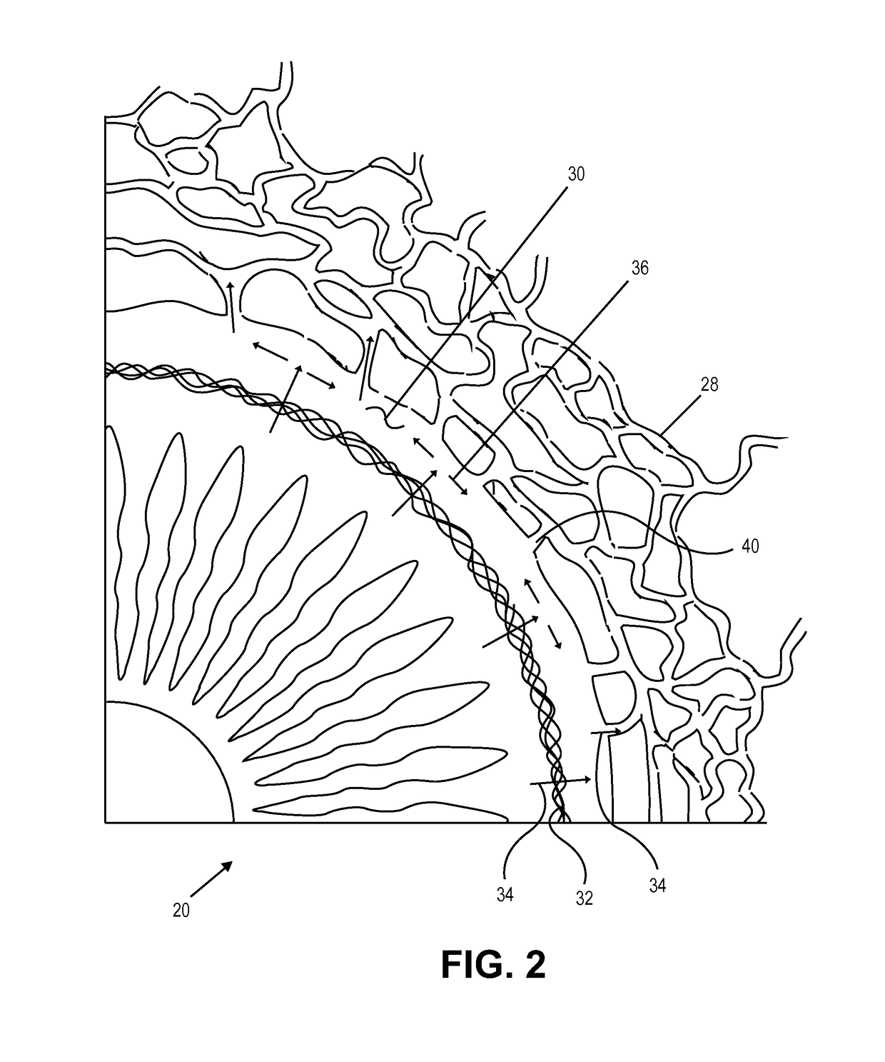 Single operator device for delivering an ocular implant