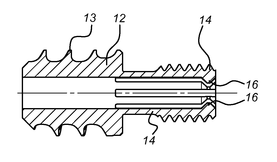 Intramedullary device for mid-shaft clavicle fractures