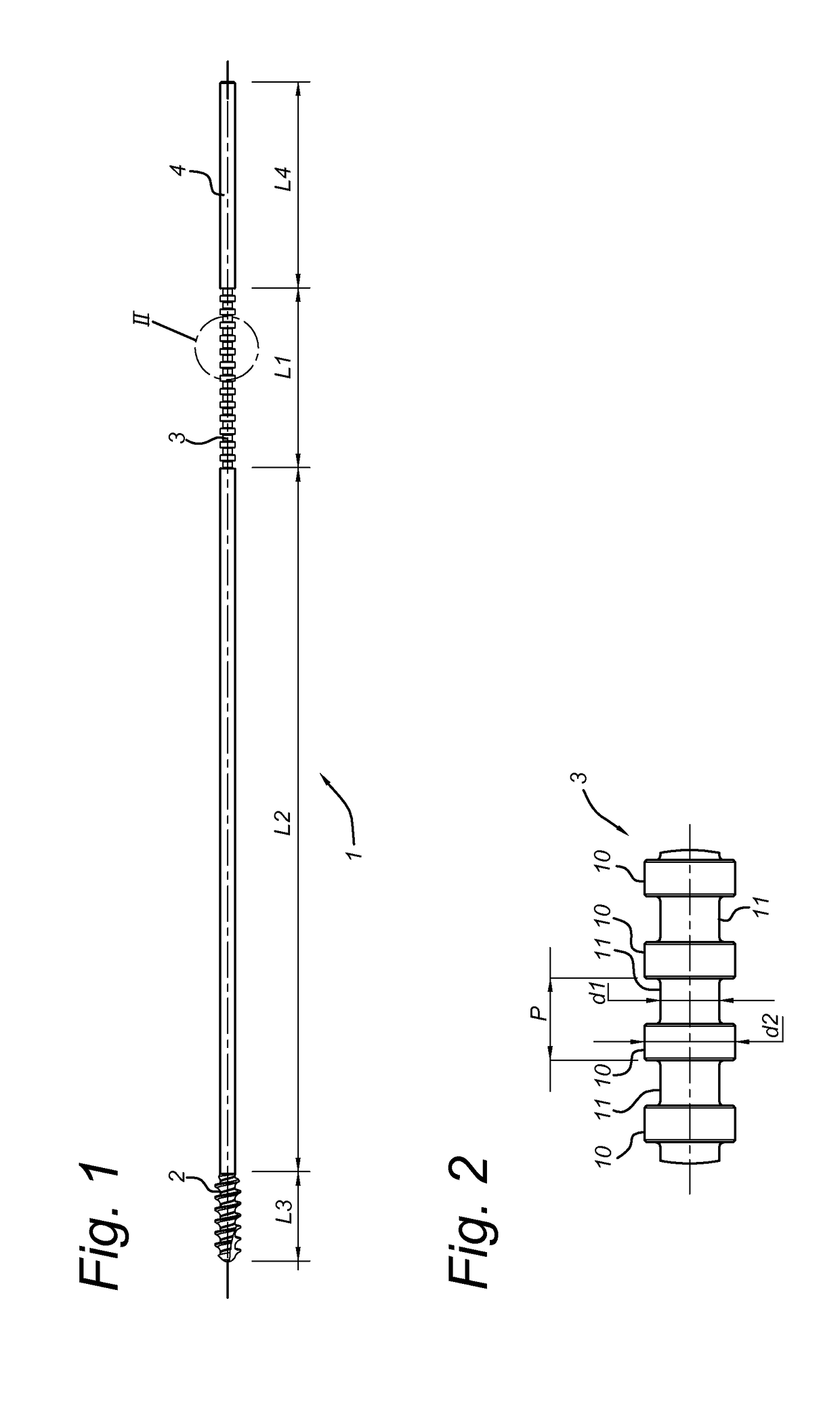 Intramedullary device for mid-shaft clavicle fractures