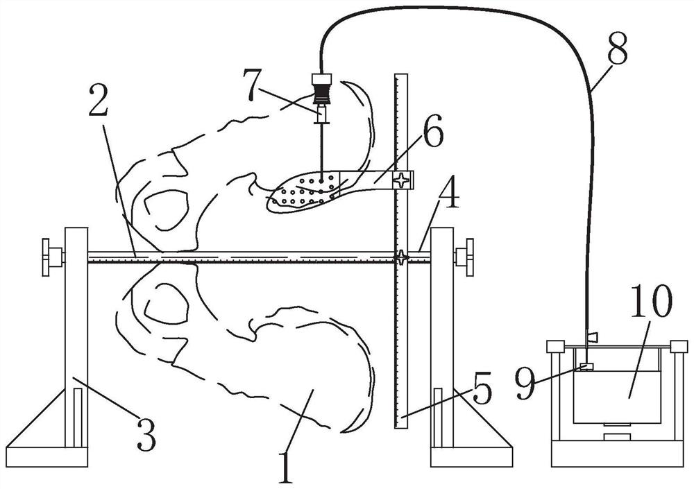 Bone marrow blood puncture point positioning, extracting and anti-coagulation device