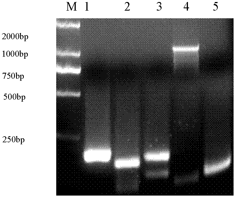 Mycoplasma bovis immunity-related protein P22, nucleotide sequence for coding same and application thereof