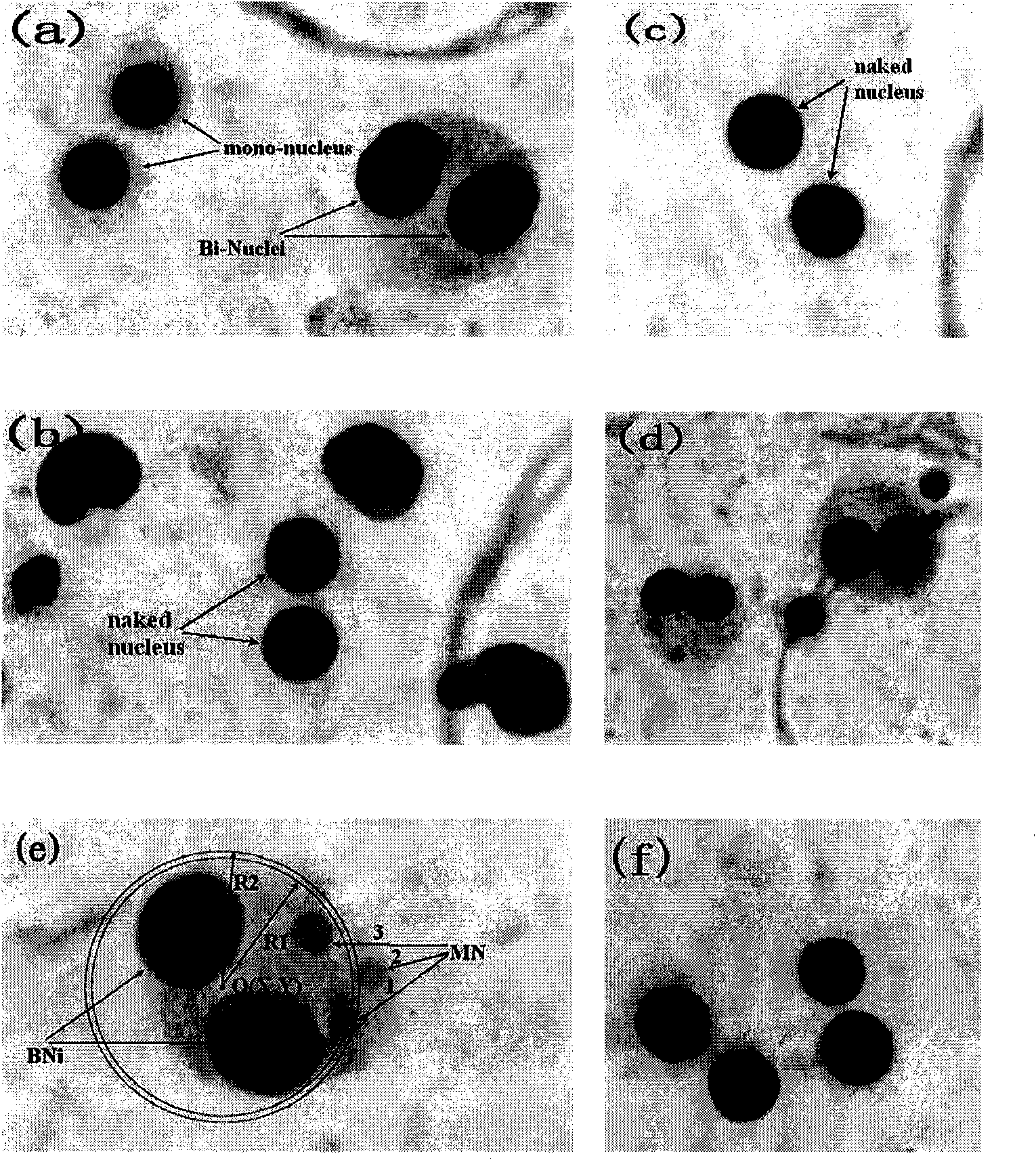 Method for extracting binuclear lymphocyte accurately and quickly in CB method micronucleated cell image