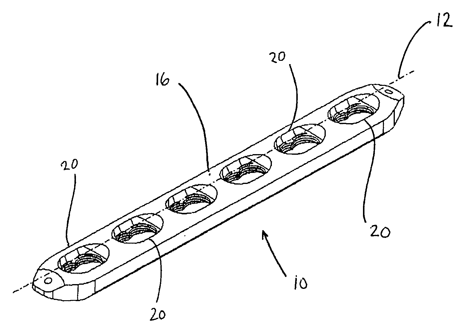 Locking bone plate