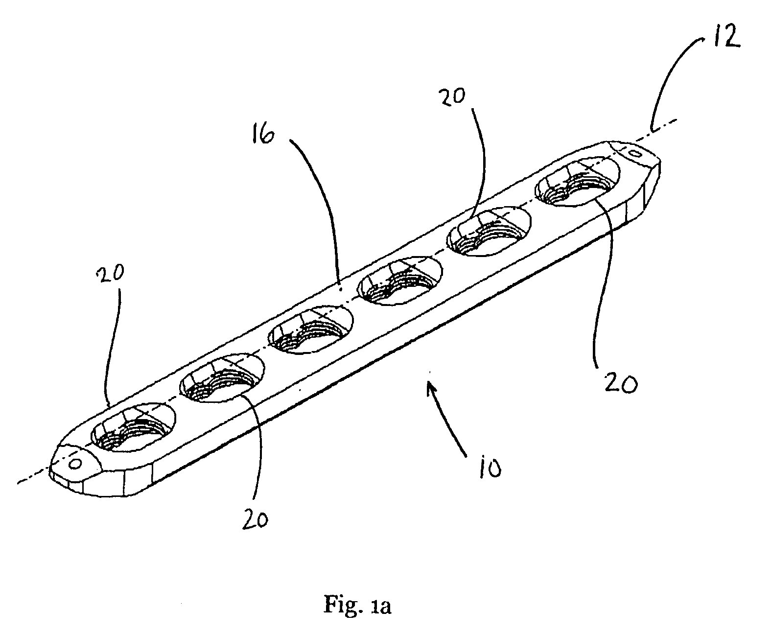 Locking bone plate