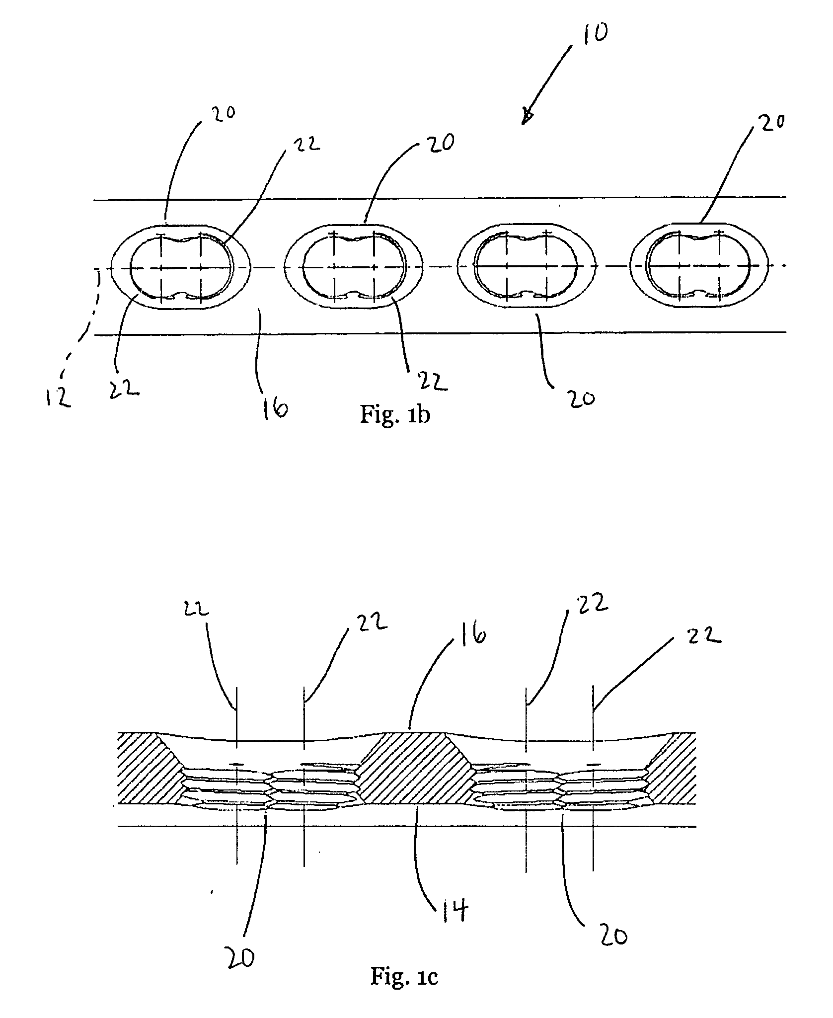 Locking bone plate