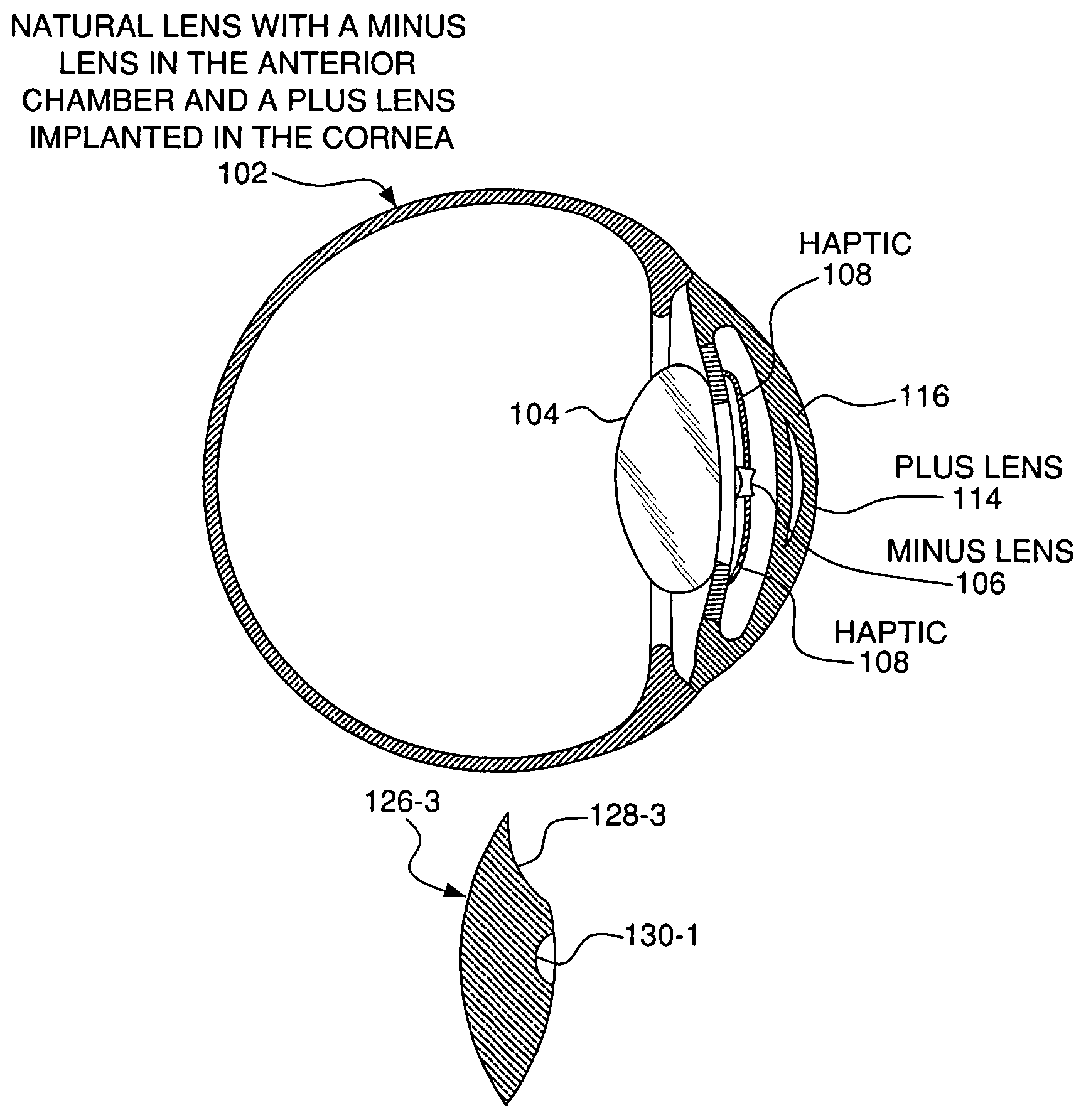 Teledioptic lens system and method for using the same