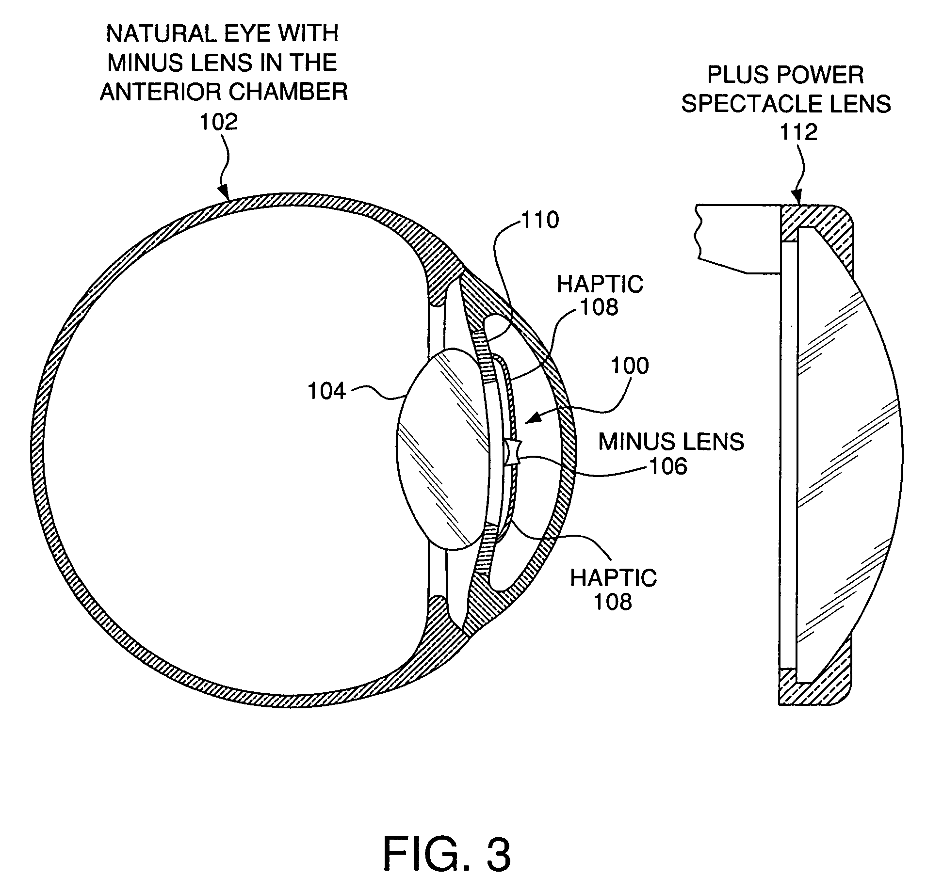 Teledioptic lens system and method for using the same