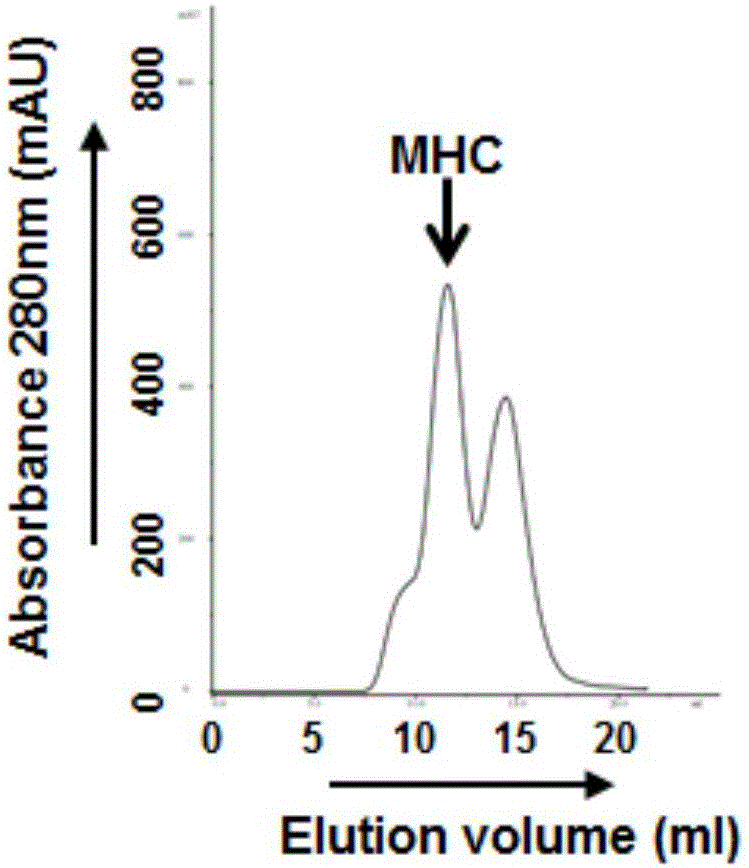 CTL (cytotoxic lymphocyte) epitope polypeptide of vascular endothelial growth factors and application of CTL epitope polypeptide