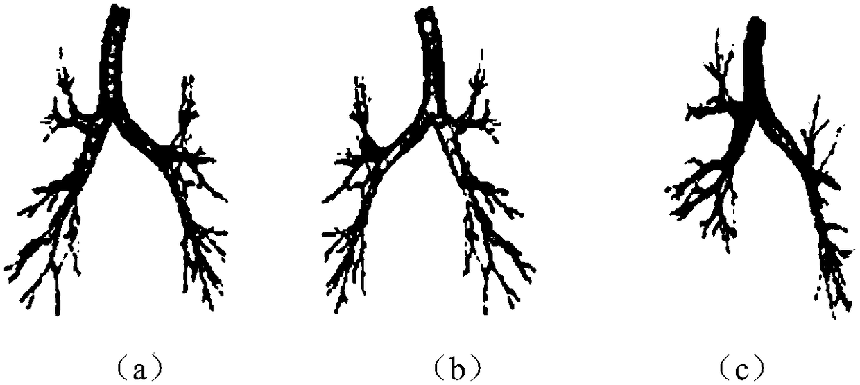 Chronic obstructive pulmonary disease prediction method based on reconstructed airway tree images