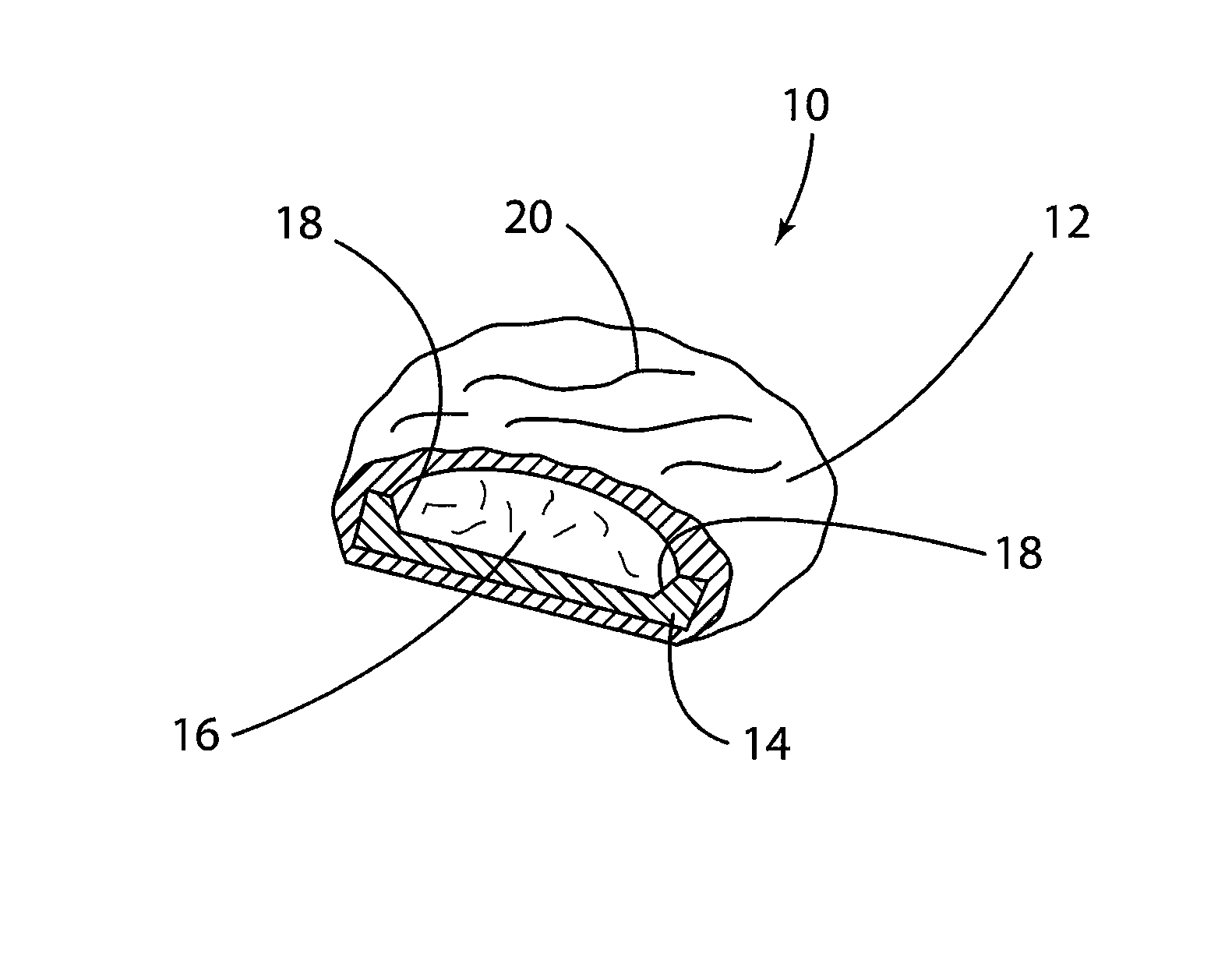 Fat bloom inhibiting food compositions and methods