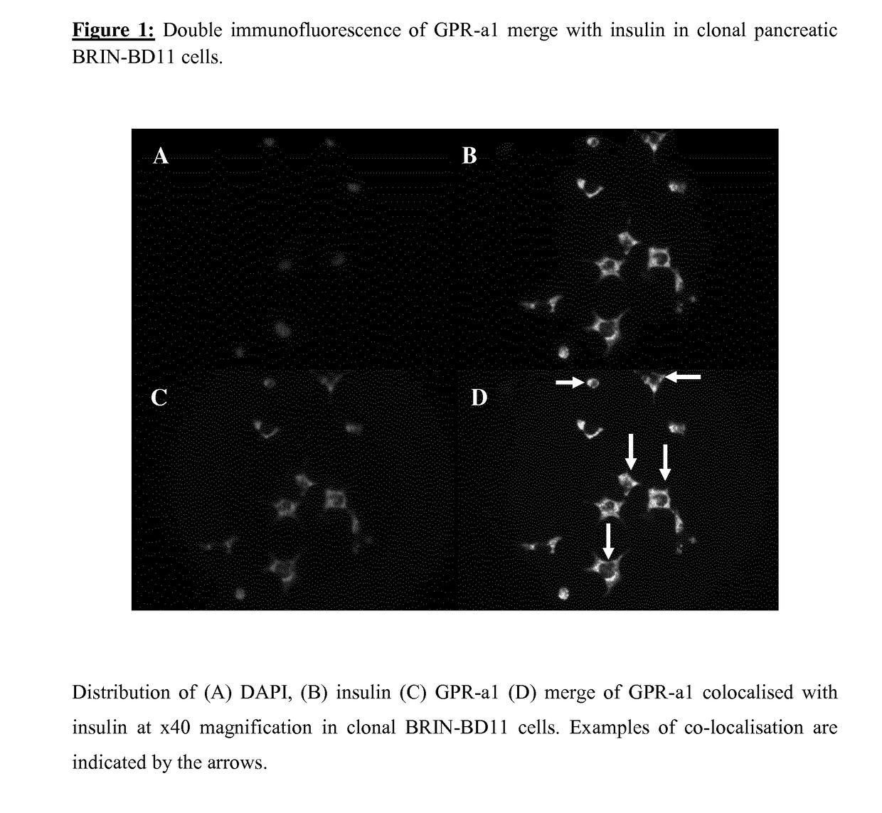 Compositions for use in the treatment of diabetes