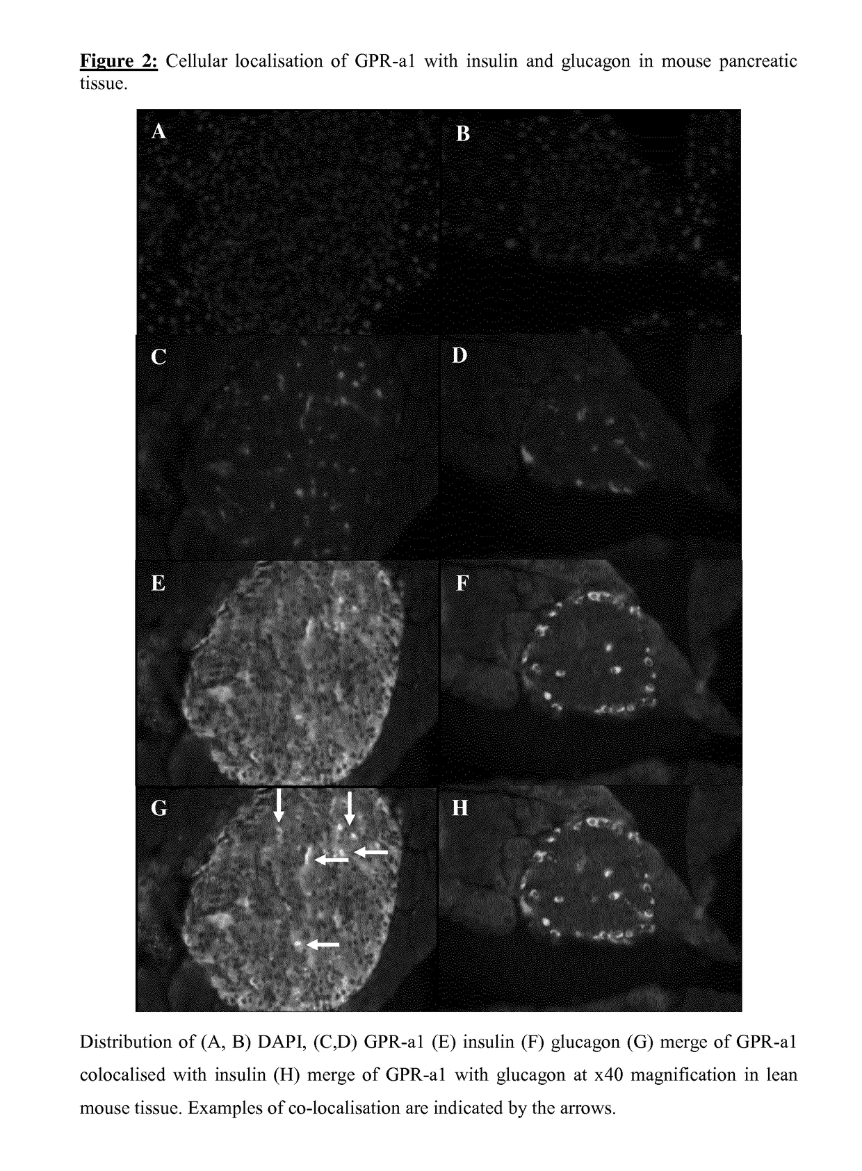 Compositions for use in the treatment of diabetes