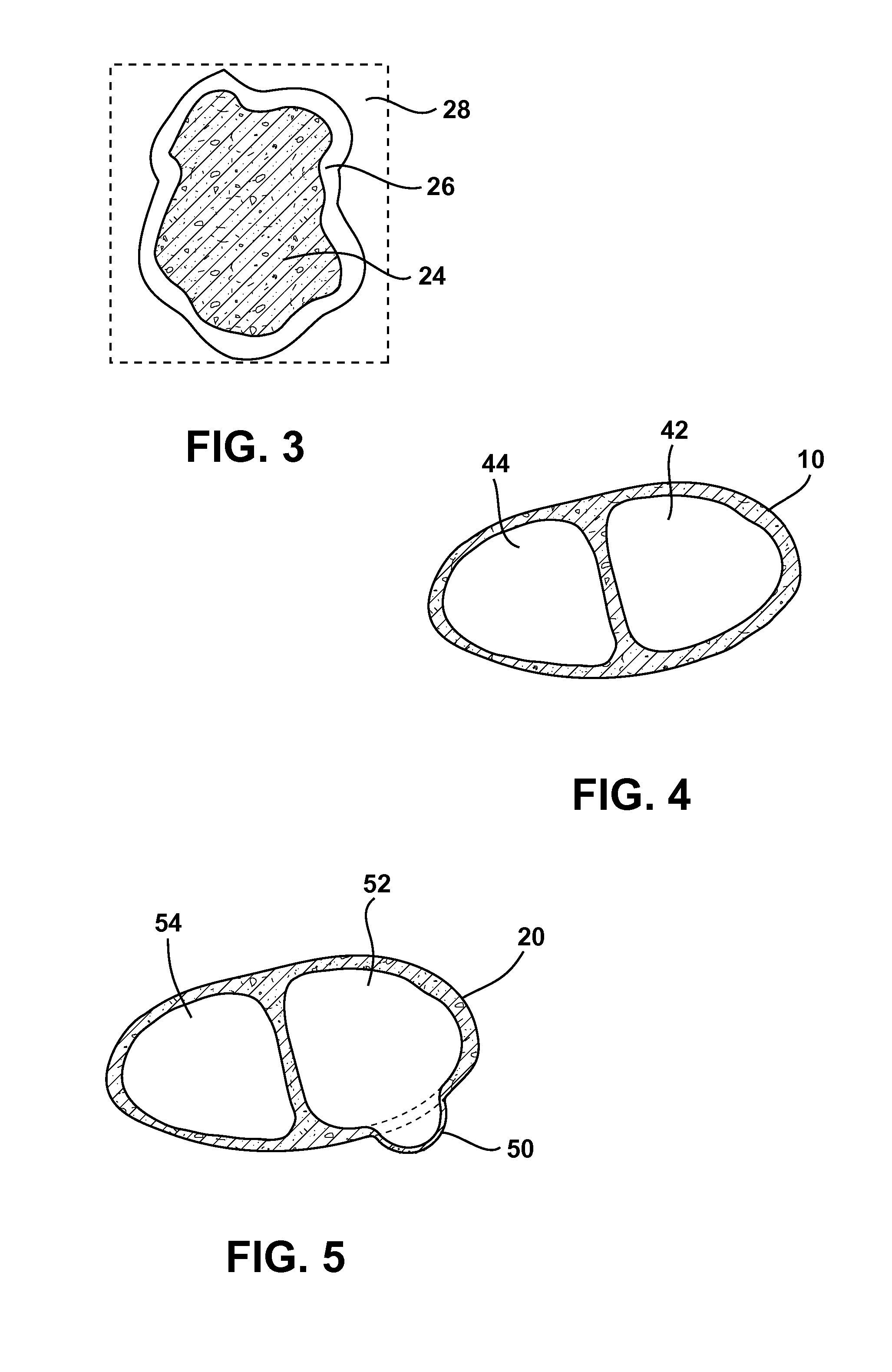 Methods and Systems for Treating Injured Cardiac Tissue