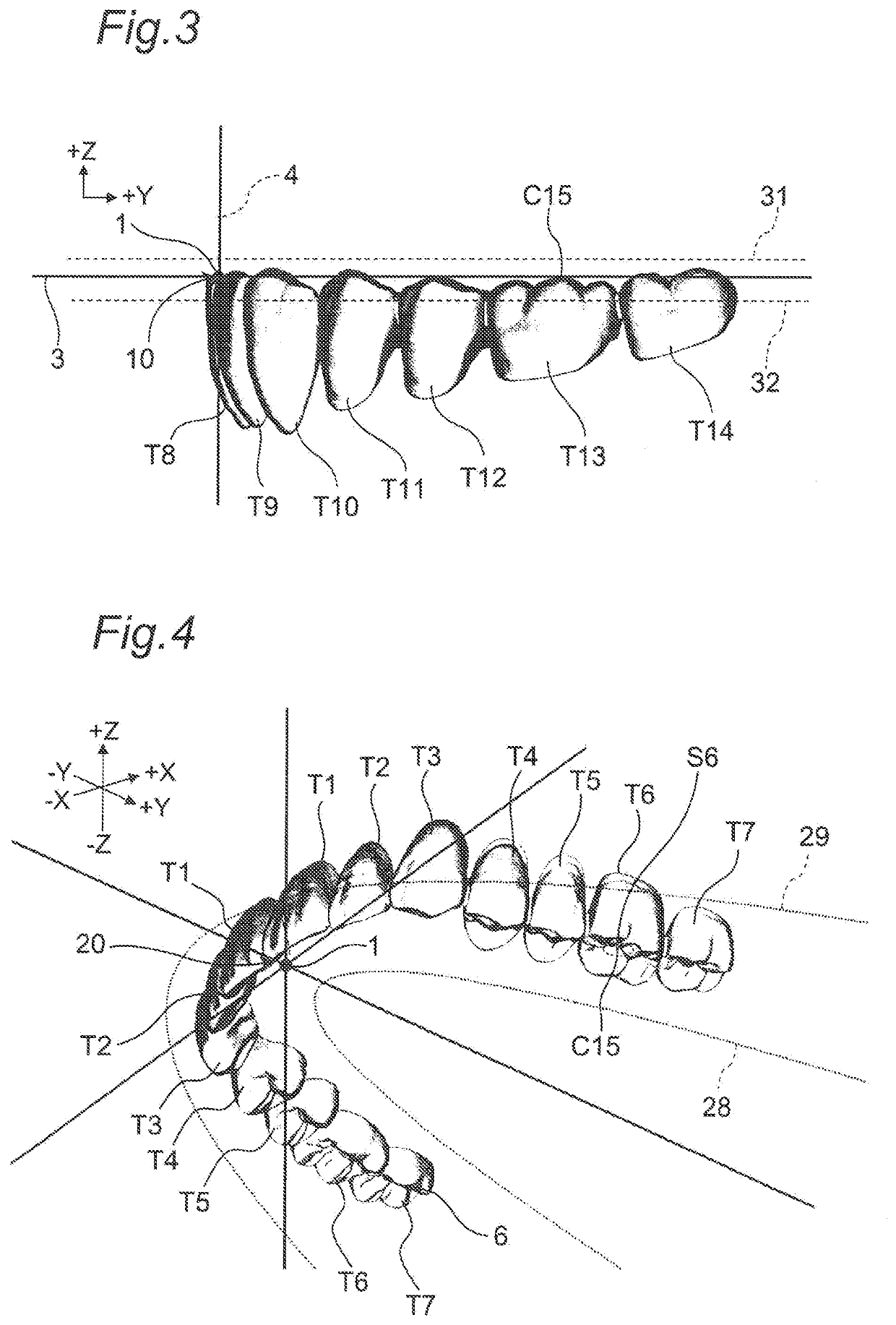 Maxillomandibular fitting type coupled artificial tooth set