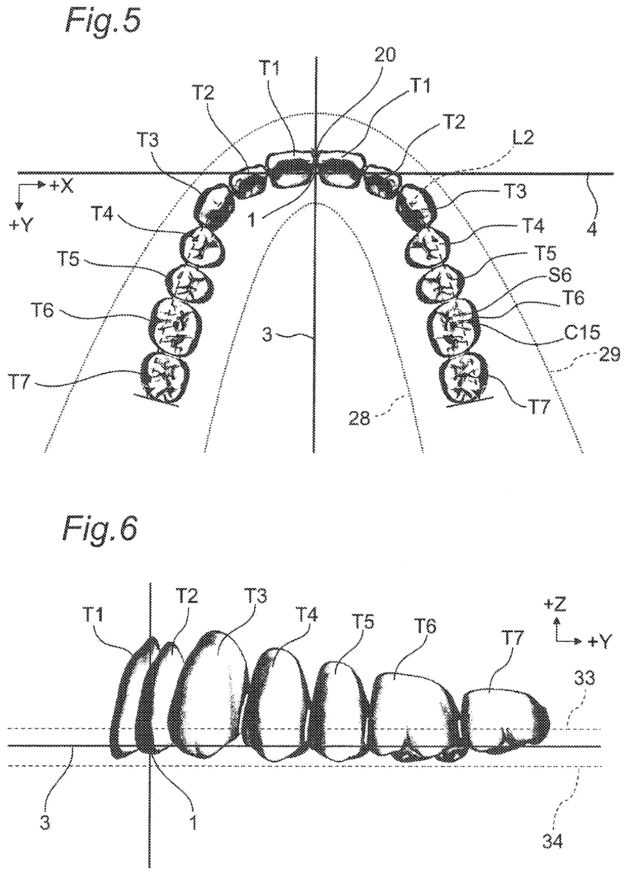 Maxillomandibular fitting type coupled artificial tooth set