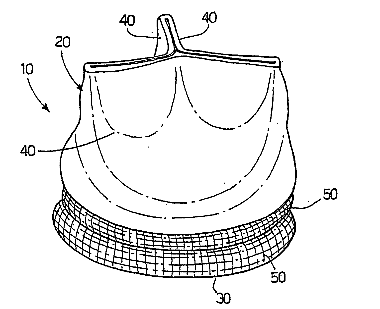 Prosthetic Valve Apparatus, In Particular for Cardiac Applications