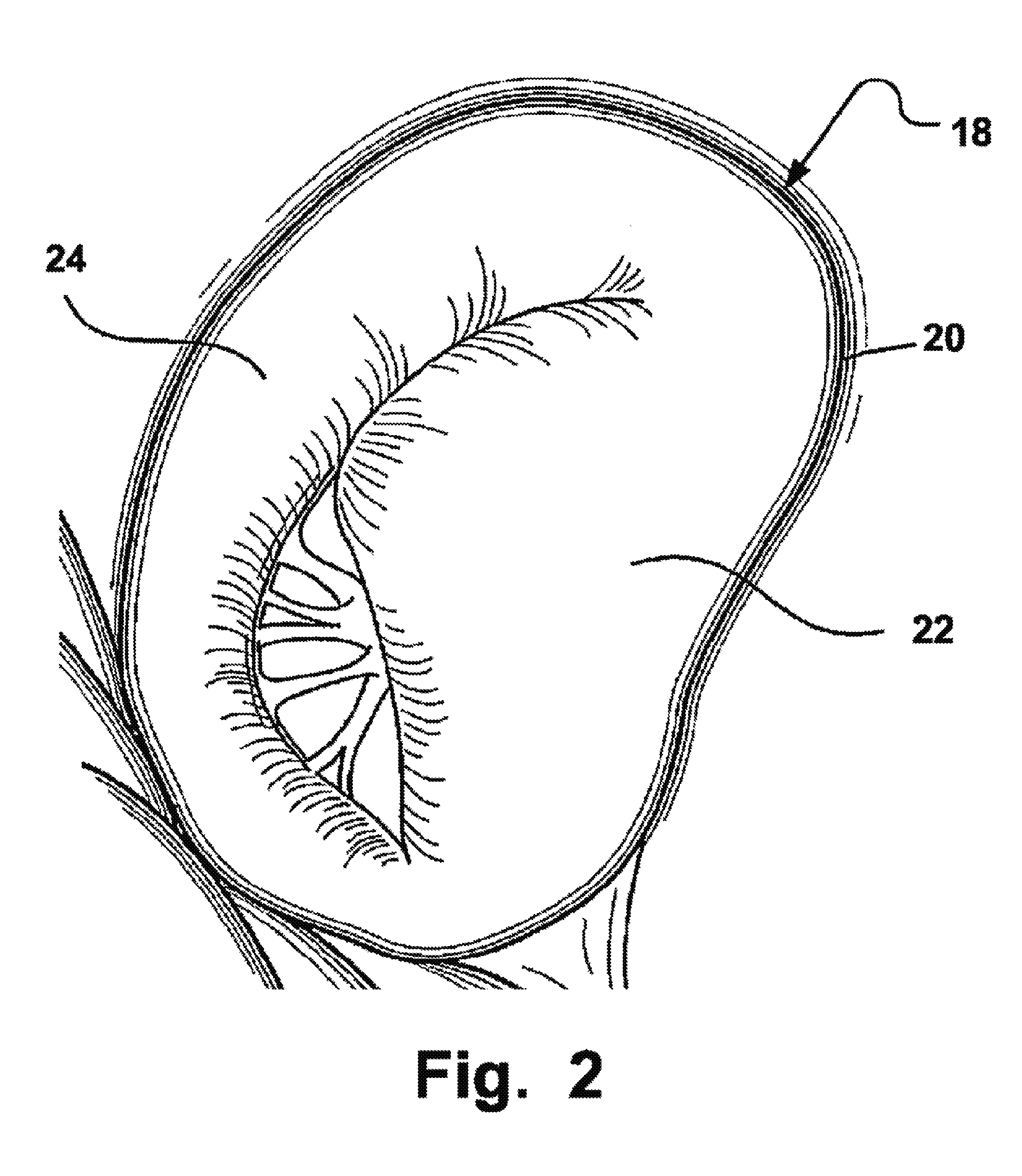 Arrangement, a loop-shaped support, a prosthetic heart valve and a method of repairing or replacing a native heart valve