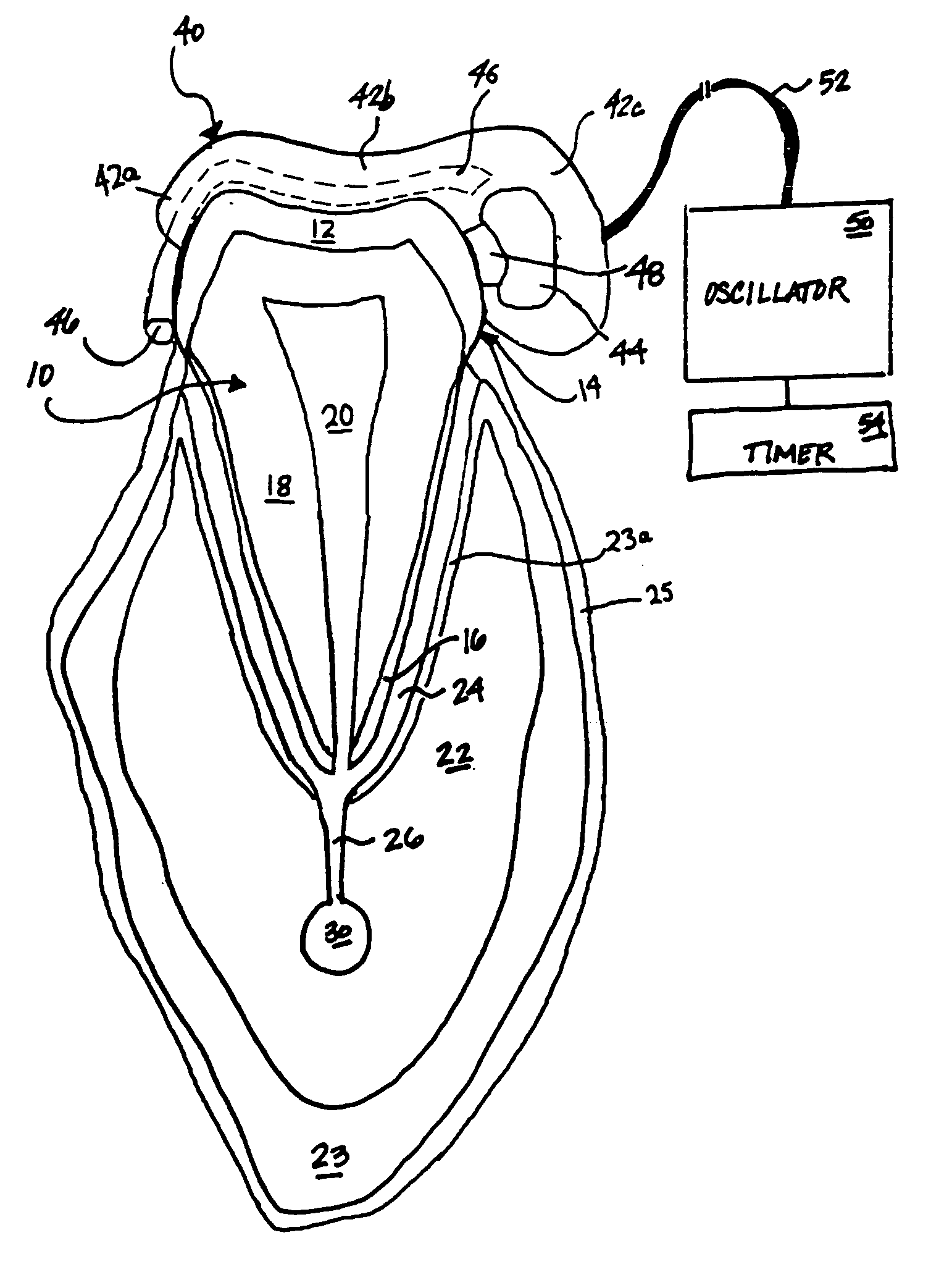 Apparatus and method for intra-oral stimulation of the trigeminal nerve