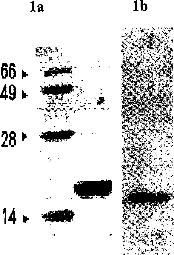 Method for producing recombined endothelium chalone in bacillus colis and application