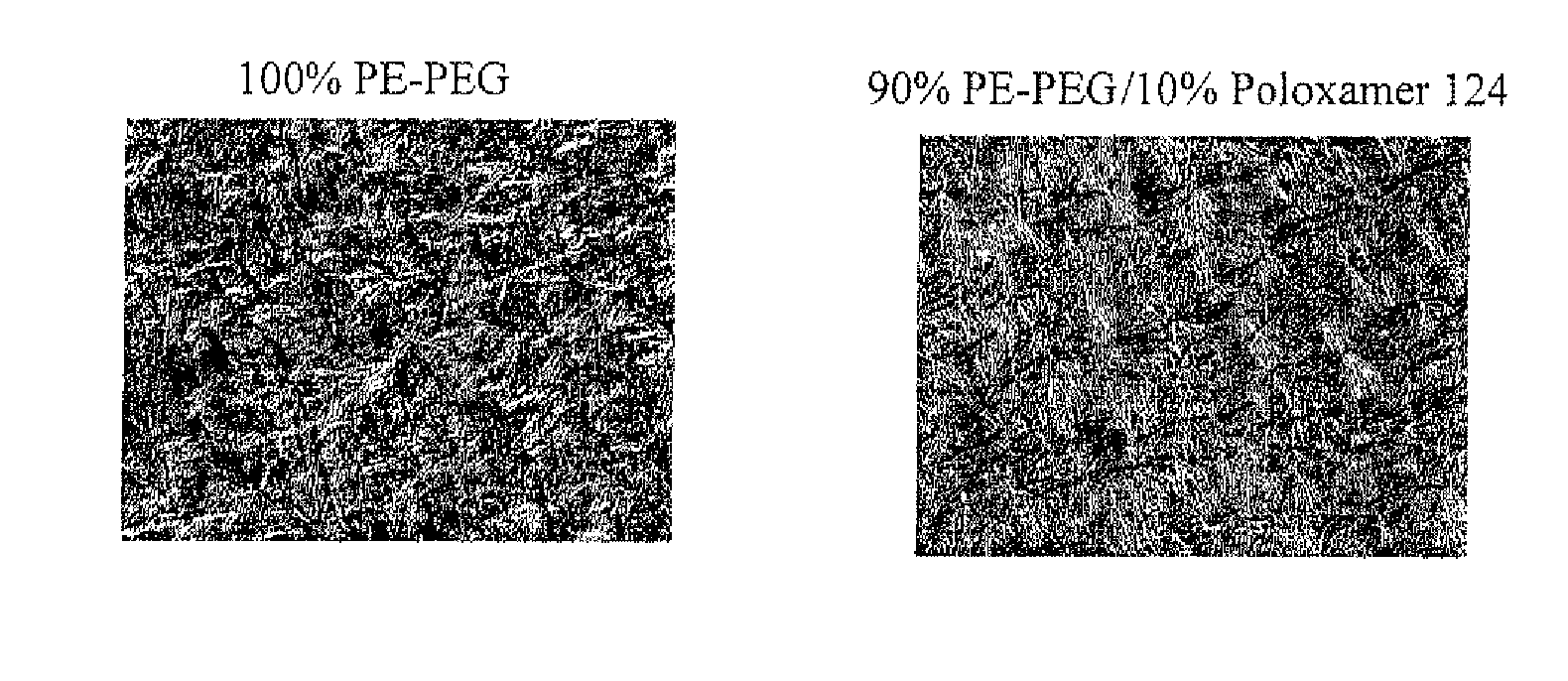 Resorbable polymer compositions for use in medicine, dentistry, and surgery