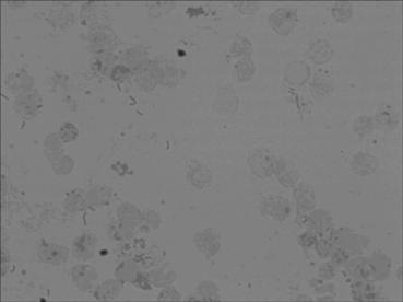 In-situ hybridization assay kit for premalignant lung cancer 14-3-3thta level as well as assay method and application