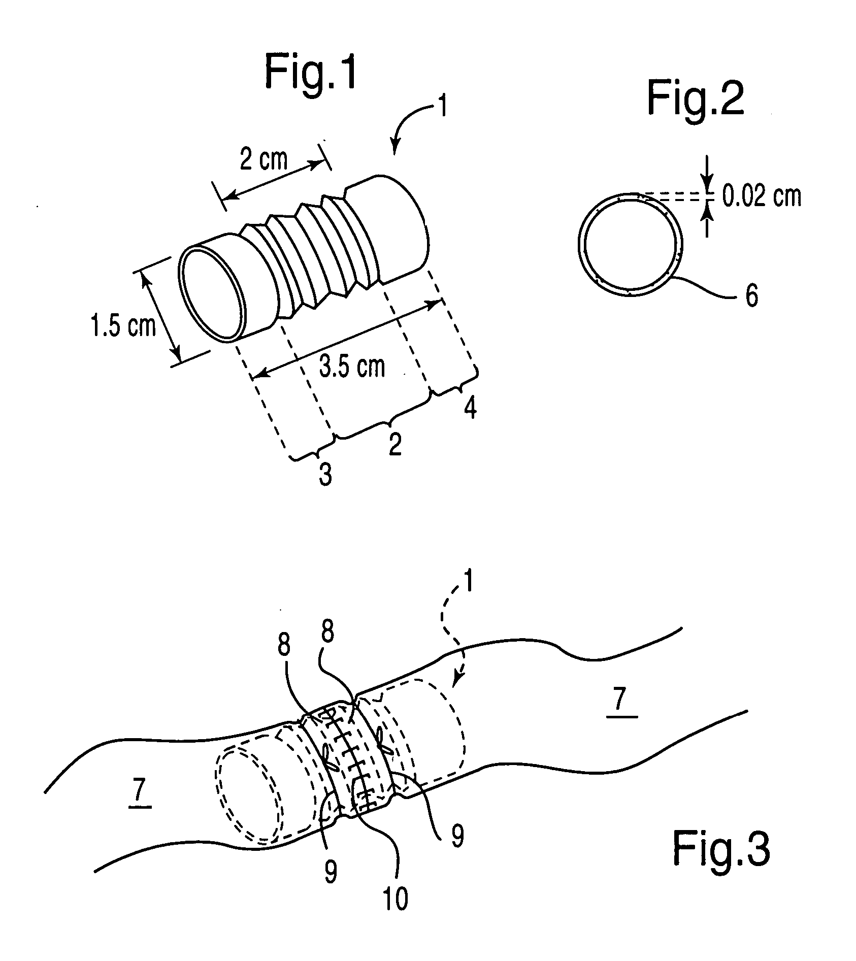 Visceral anastomotic device and method of using same