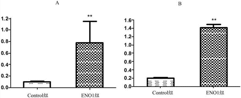 Application of anti-ENO1 (alpha-enolase) autoantibody in AIT (autoimmune thyroiditis) pregnant woman screening and abortion risk prediction
