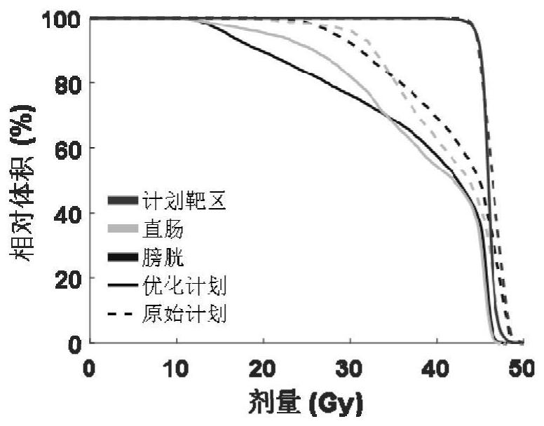 Intensity-modulated radiotherapy plan optimization system, medium and equipment guided by predictive dose distribution