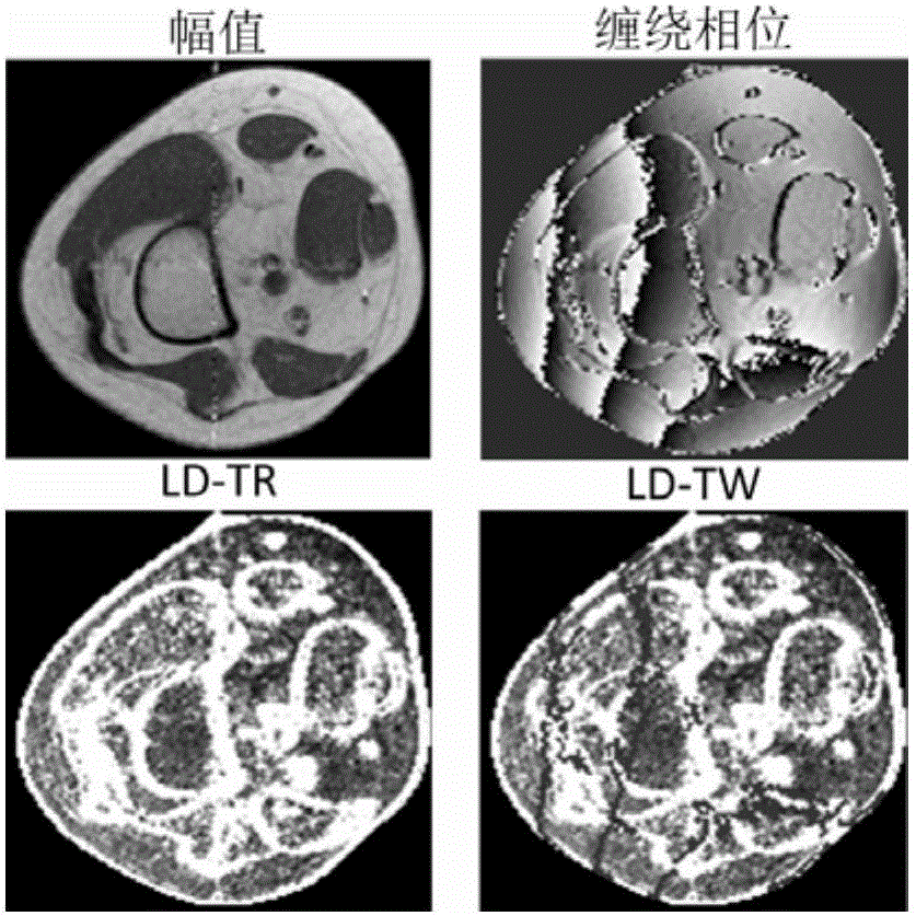 Magnetic resonance phase unwrapping method based on pixel classification and local surface fitting