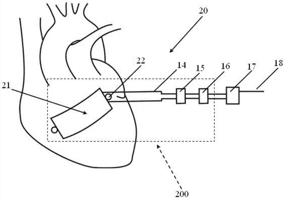 self powered brain pacemaker