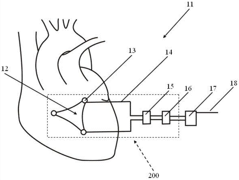 self powered brain pacemaker