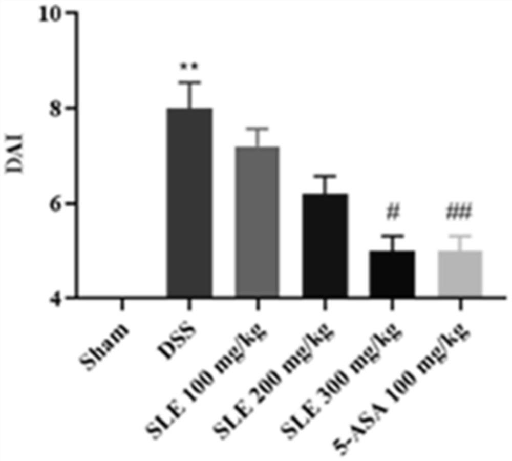 Pharmaceutical composition for treating ulcerative colitis and application thereof