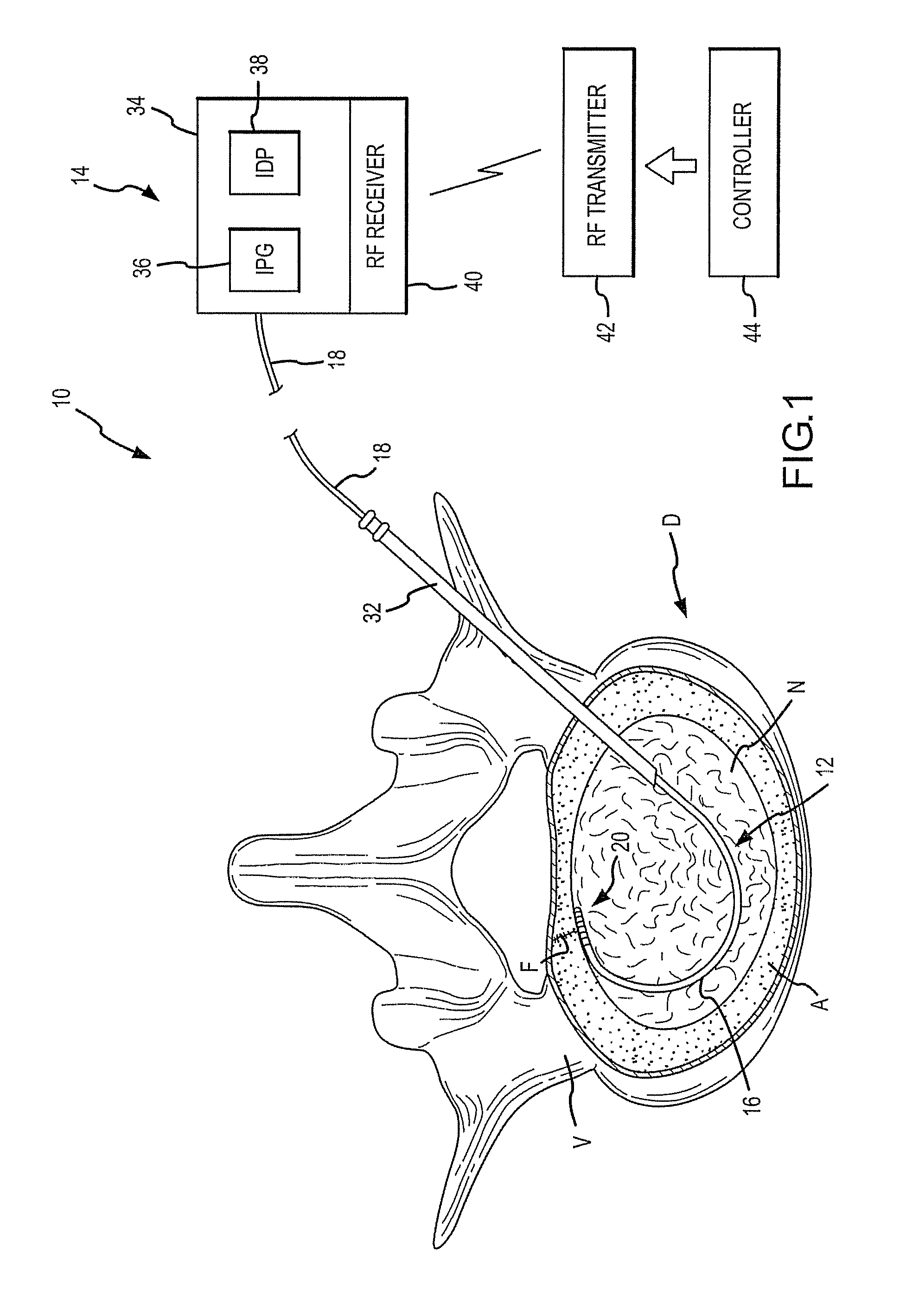 Combination Electrical Stimulating and Infusion Medical Device and Method