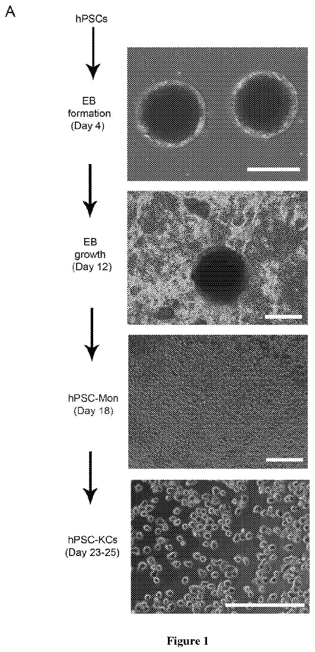 Methods of generating hepatic macrophages and uses thereof